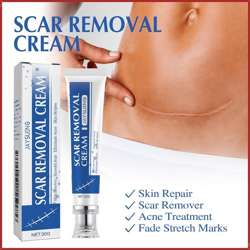 Crema para Eliminar Cicatrices